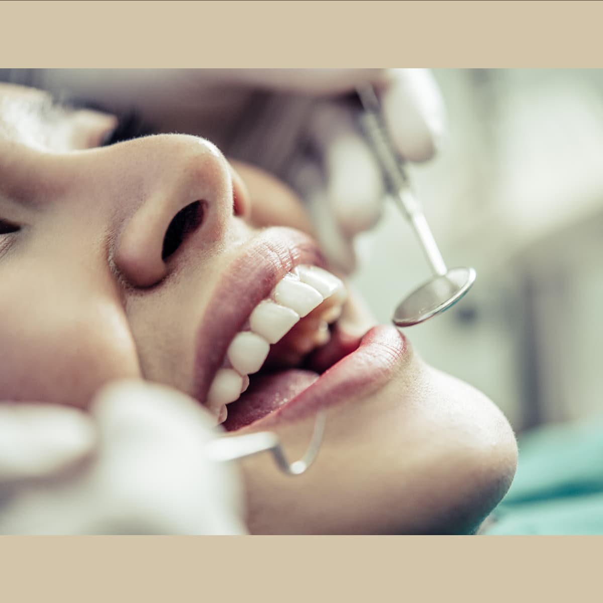 Teeth Cleaning & Scaling